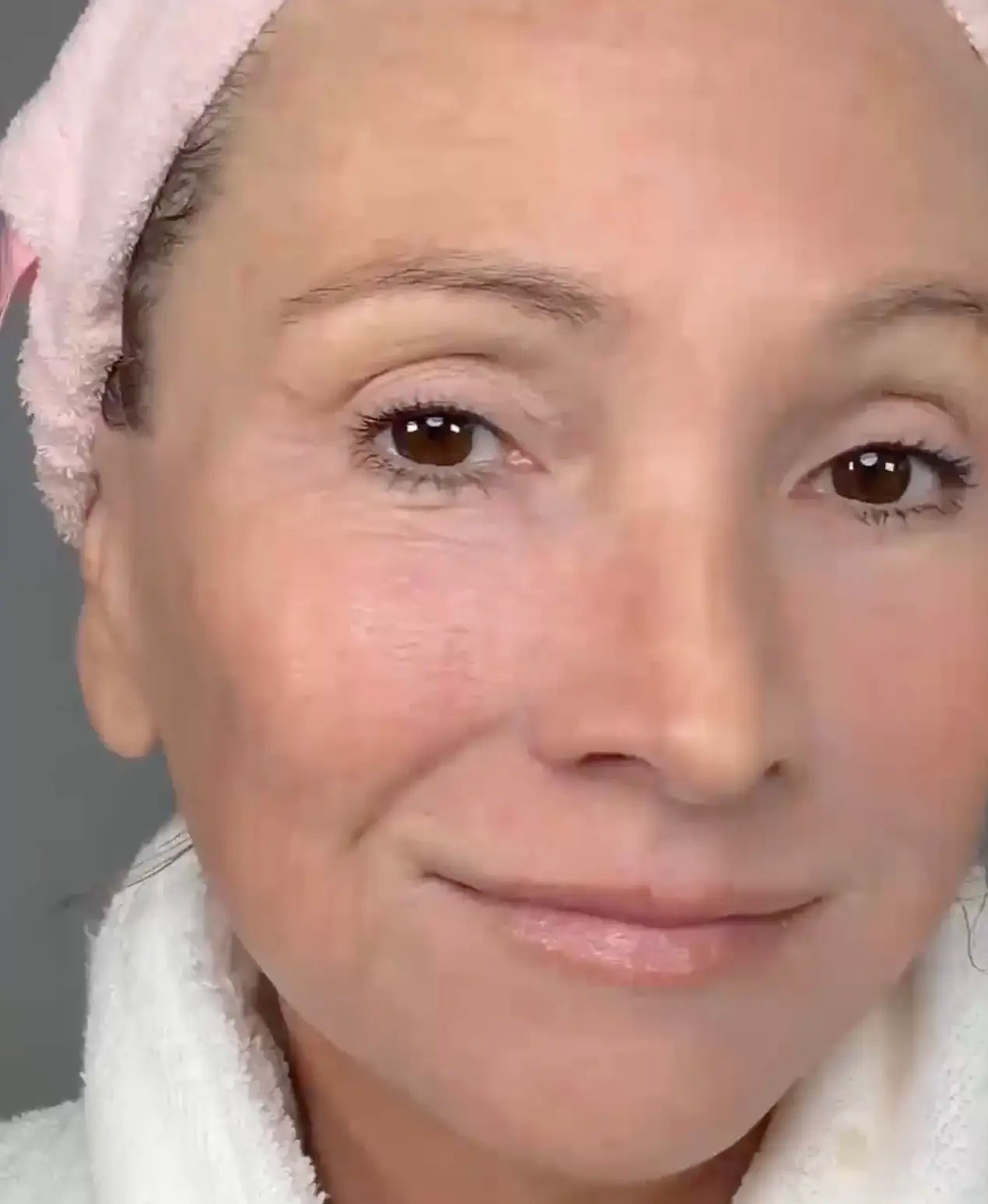 Best Ingredients For Skin Hydration