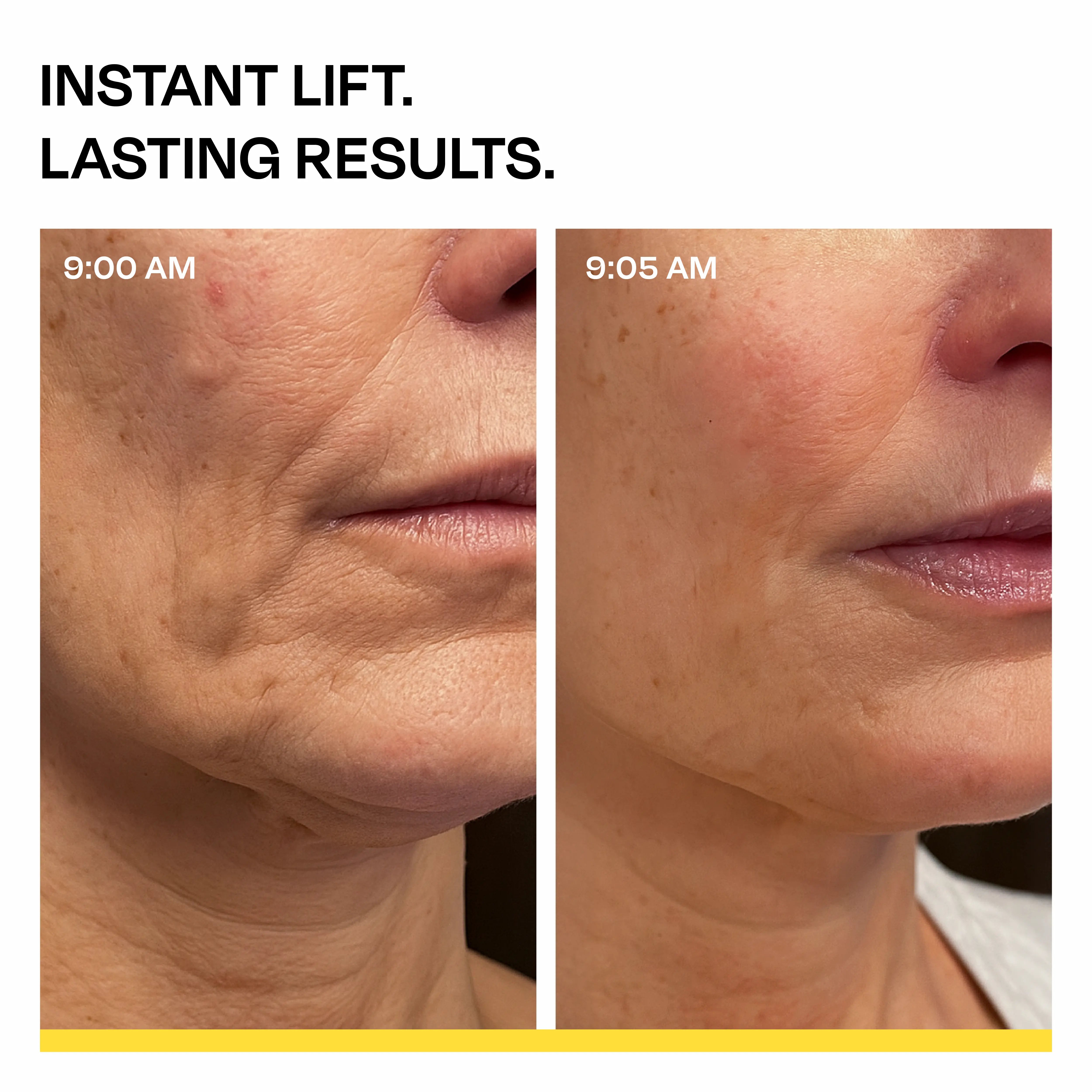 Dual Action Lifting Cream