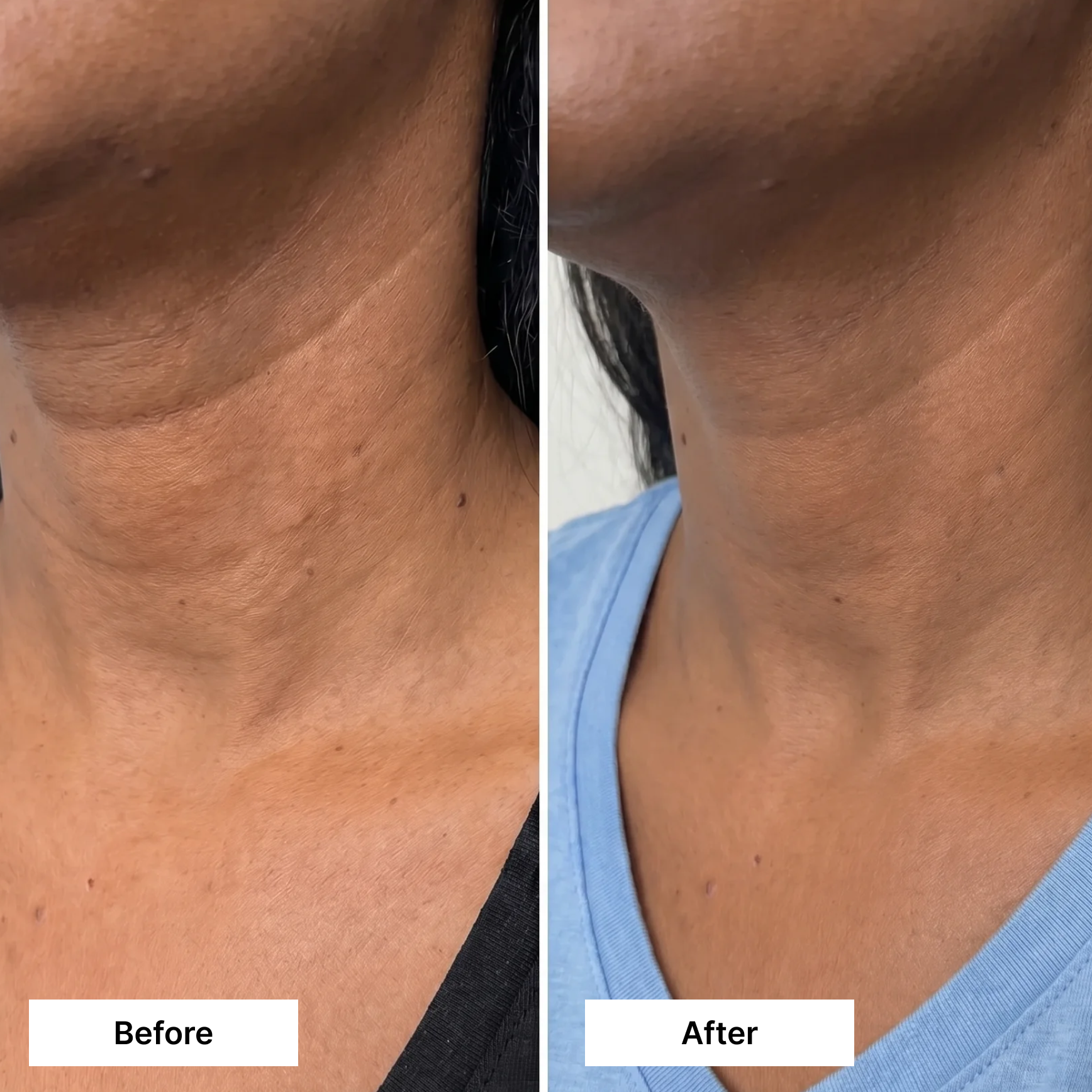 Dual Action Lifting Cream
