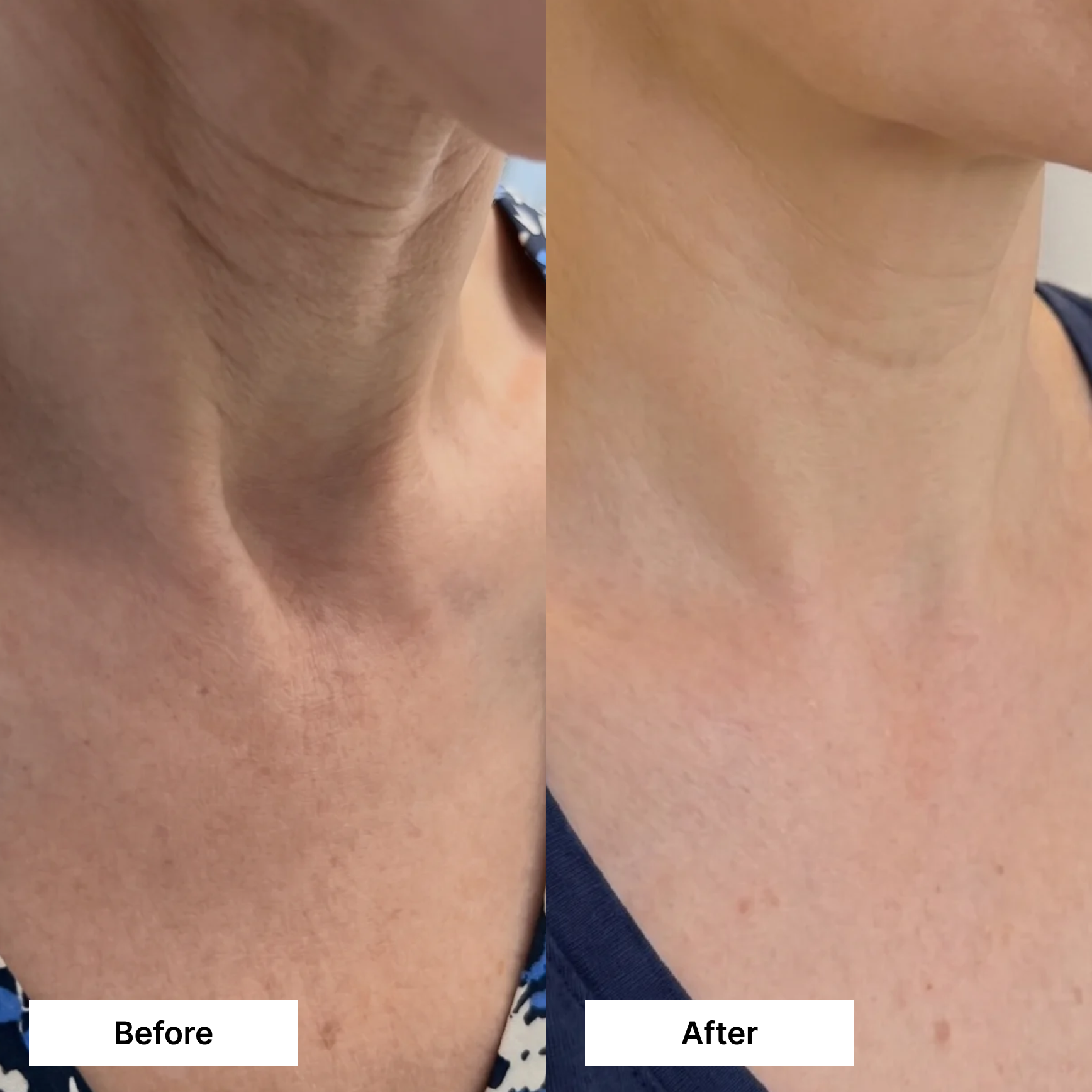 Dual Action Lifting Cream