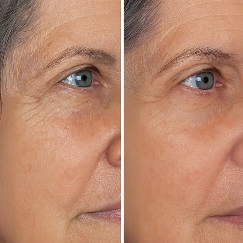 When To Apply Retinol In Skincare Routine