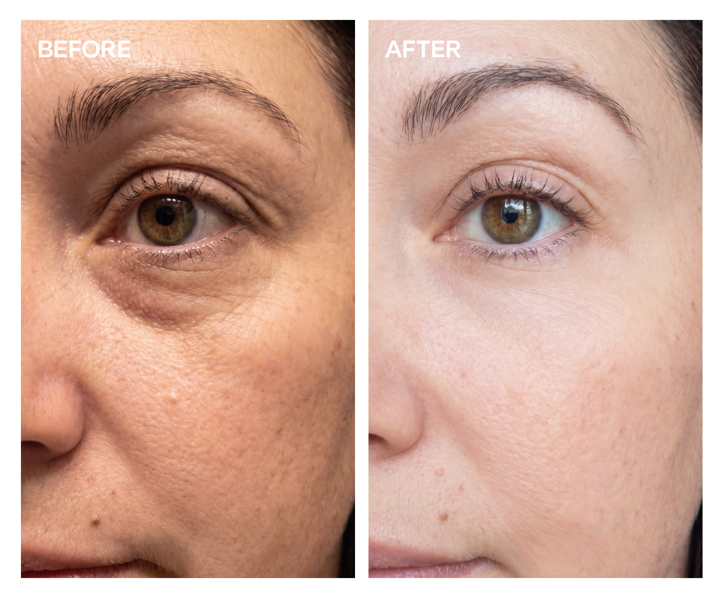 Face Moisturizer Guide: How to Choose the Best Face Moisturizer for Your Skin