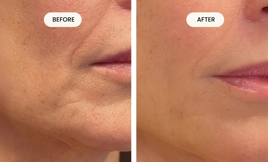 OKOA Dual Action Lifting Cream lifestyle