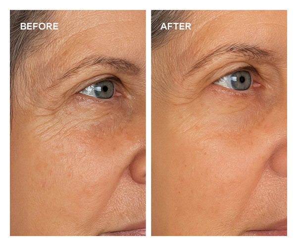 That tight feeling? It’s your lift activatingOur Dual Action Lifting Cream forms a peptide-based tightening film on the surface of your skin. That’s how you get the instant “lifted” effect. For a comfortable, seamless finish:
